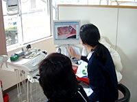 口腔内写真による説明