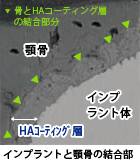 HAコーティング