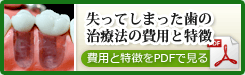 失ってしまった歯の治療法の費用と特徴一覧について詳しく見る